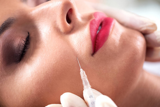 Mooi aantrekkelijke vrouw doen rimpel behandeling in de buurt van lippen met botox - Foto, afbeelding