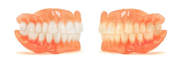 Close-up van kunststof prothese tanden isoleren geen dol op achtergrond. Nieuwe technologieën in de moderne tandartsen. - Foto, afbeelding