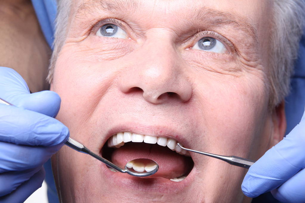 Old caucasian man treats a tooth at the dentist - Fotó, kép