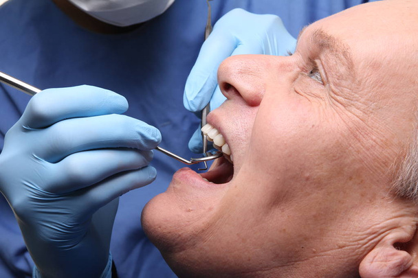 Old caucasian man treats a tooth at the dentist - Фото, изображение