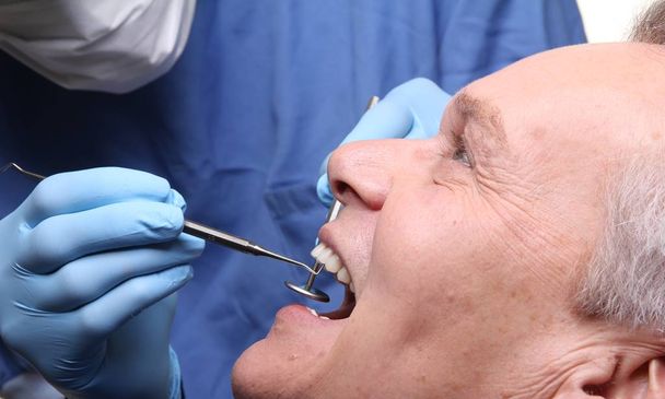 Stary człowiek kaukaski traktuje zębów u dentysty - Zdjęcie, obraz