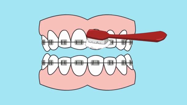 Opieka stomatologiczna - animacji wektorowych - Materiał filmowy, wideo