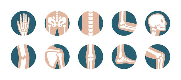 Набір людських суглобів і кісток. Векторне коліно, нога, таз, лопатка, череп, лікоть, піктограми ноги та руки. Ортопедичні та скелетні символи на білому тлі
 - Вектор, зображення