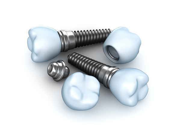 Set of dental implants - Photo, Image