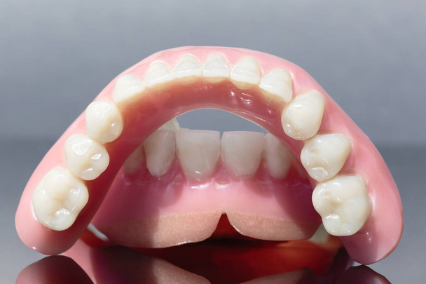 Lääketieteellinen proteesi leuka hampaat eristetty harmaa backgroun
 - Valokuva, kuva