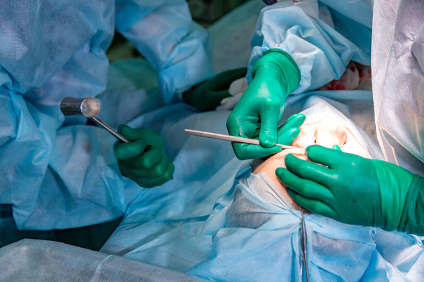 Хирург и его ассистент проводят косметическую операцию на носу в операционной больницы. Изменение формы носа, увеличение. Ринопластика
. - Фото, изображение