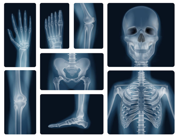 Ihmisen luut Realistiset röntgenkuvat
 - Vektori, kuva