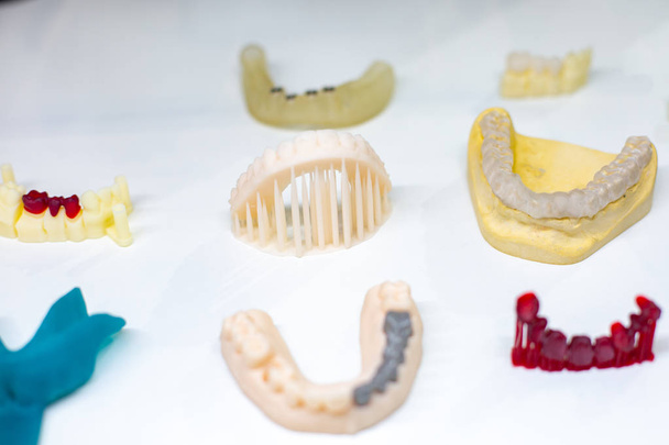 Outils d'orthodontie dentaire. Dispositif multicolore pour faire une dent moulée. Moulage des dents
. - Photo, image