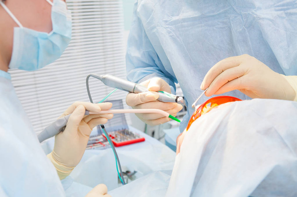 El proceso de primer plano del cirujano dentista profesional masculino que realiza la operación instala los dientes del implante dental del hombre paciente en la clínica
. - Foto, Imagen