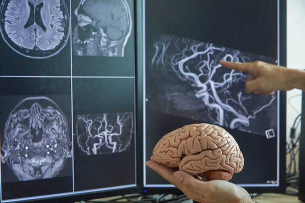 Human brain model on doctor hand. Neurologist demonstrating brain MRI on computer monitor. - Photo, Image