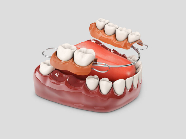 Ανθρώπινα δόντια με οδοντοστοιχία. 3D απεικόνιση απομονωμένη λευκό - Φωτογραφία, εικόνα