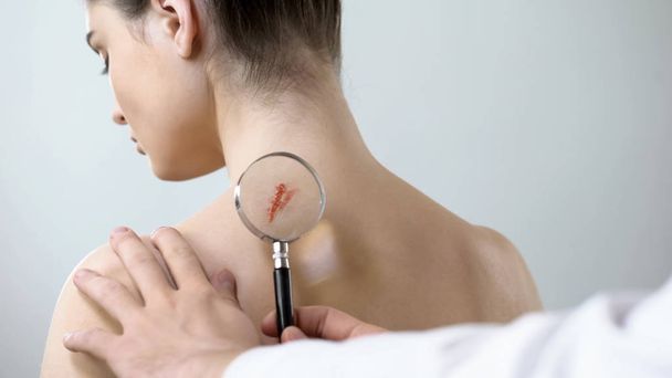 Therapist examining wound on female shoulder with magnifying glass, health care - Фото, зображення