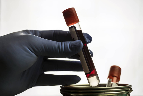 Doutor detém amostra de sangue em uma mesa de hospital, imagem conceitual
 - Foto, Imagem