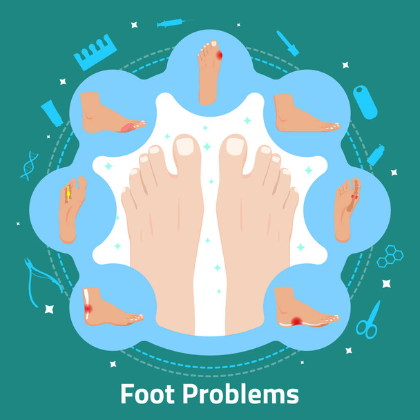 Foot Problems Flat Composition - Vector, Image