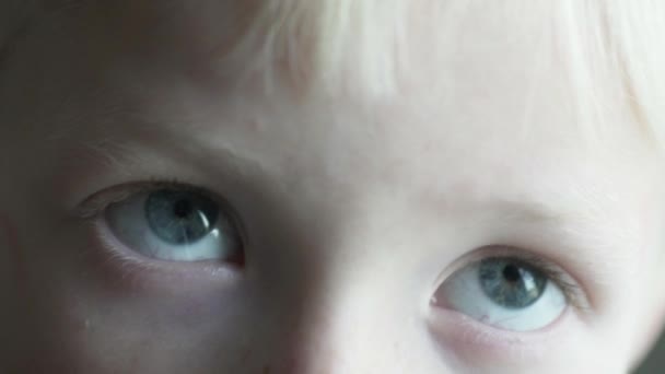 Makró felvétel. Szemében egy albínó szőke fiú közelről - Felvétel, videó