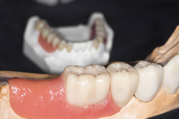 τεχνητή ούλων με δόντια γκρο πλαν, εικόνα φόντου - Φωτογραφία, εικόνα