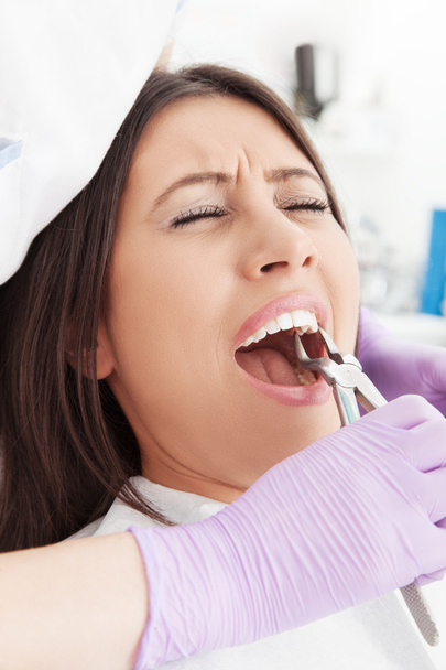 Dentist extracting the tooth - Fotoğraf, Görsel