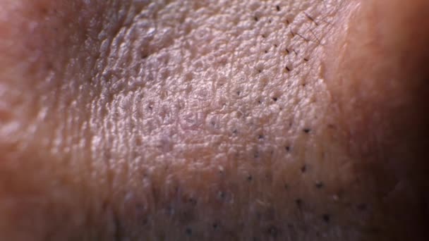 Κοντινό πλάνο της ανθρώπινης υφής του δέρματος  - Πλάνα, βίντεο