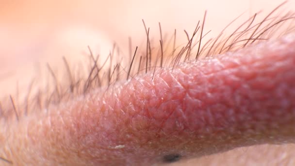 Close up van menselijke huidtextuur  - Video