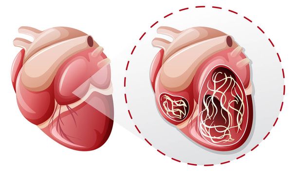 vergroot hart worm concept illustratie - Vector, afbeelding