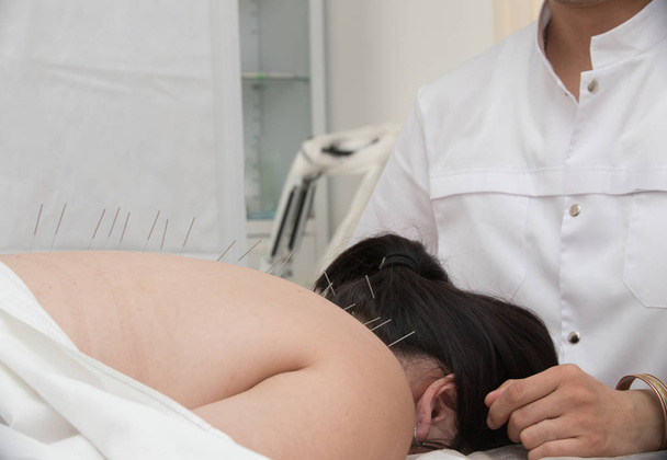Giovane donna sdraiata sul divano medico. Terapista che esegue un trattamento di agopuntura sul collo e sulla schiena del paziente
 - Foto, immagini