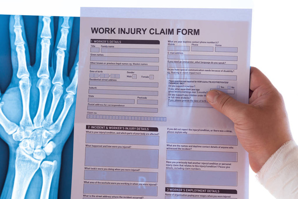 homem lendo um formulário de pedido de lesão de trabalho com uma mão enrolado em cima de um filme de raios X conceito médico e seguro
 - Foto, Imagem