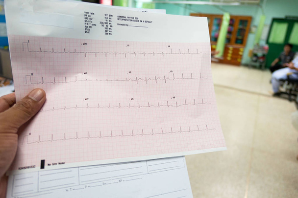 Análise cardíaca, eletrocardiograma (ECG) em médico de mão no hospital
 . - Foto, Imagem