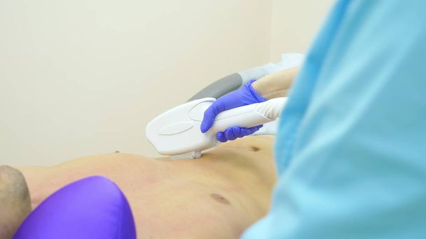 male laser hair removal. a doctor in gloves removes hair from the abdomen and breasts of a man. close-up. - Foto, afbeelding