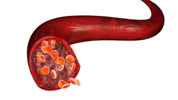 Rote Blutkörperchen und Blut fließen durch eine Vene, kleine kugelförmige Zellen, die Hämoglobin enthalten, ein Protein, das dem Blut eine rote Farbe verleiht und in der Lage ist, Sauerstoff durch das Eisen in ihm zu binden. Bluttest - Foto, Bild
