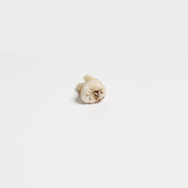 ausgerissene schlechte Wurzel menschlicher Zahn in Nahaufnahme auf weißem Hintergrund - Foto, Bild