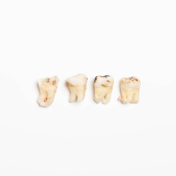arrancó los malos molares dientes humanos de cerca sobre fondo blanco
 - Foto, Imagen