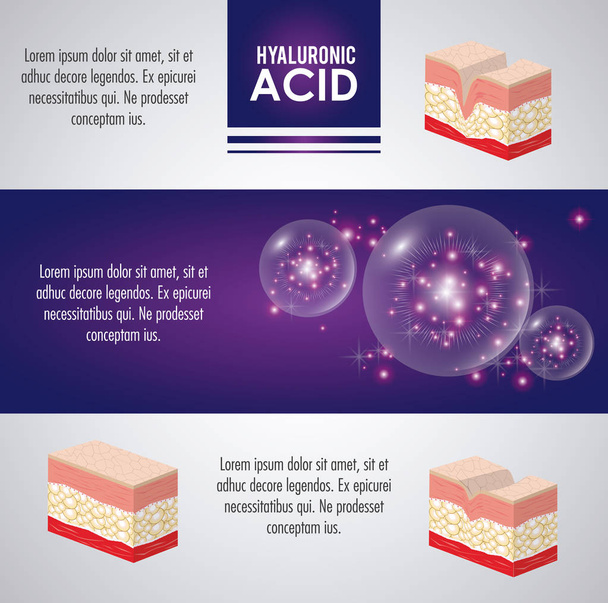 hyaluronic acid filler injection infographic - Vector, Image