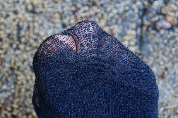Un doigt sur la jambe d'une vieille chaussette noire en lambeaux
 - Photo, image