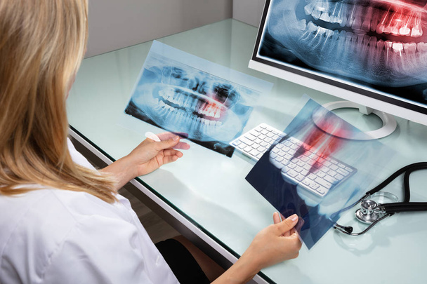 Крупный план женщины-дантиста, смотрящей на рентген зубов в клинике
 - Фото, изображение