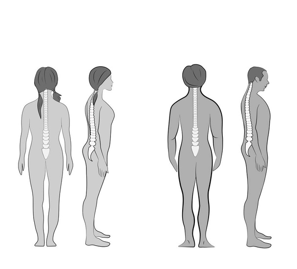 Alineación correcta del cuerpo humano en postura de pie para una buena personalidad y saludable de la columna vertebral y el hueso. Salud e ilustración médica
 - Vector, imagen