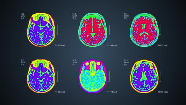 Rastreamento cerebral. 6 visualizações em uma tela. fundo colorido médico 4k
 - Filmagem, Vídeo