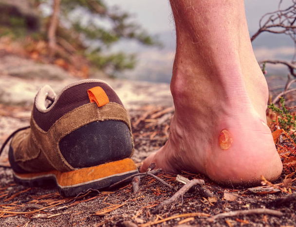 Big bloody callus on man heel.   Sandstone rock with tired hikers legs without shoes.  Outdoor activities. - Photo, Image