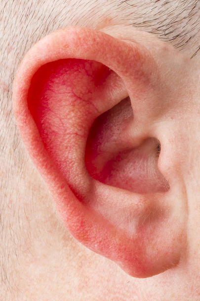 head of a man and the red ear. A sign of telling lies. Sick ear - 写真・画像