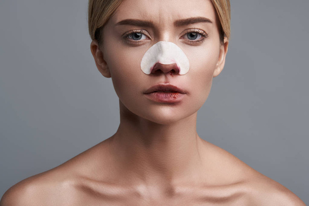 Woman with bloody nose looking serious and frowning - Фото, изображение
