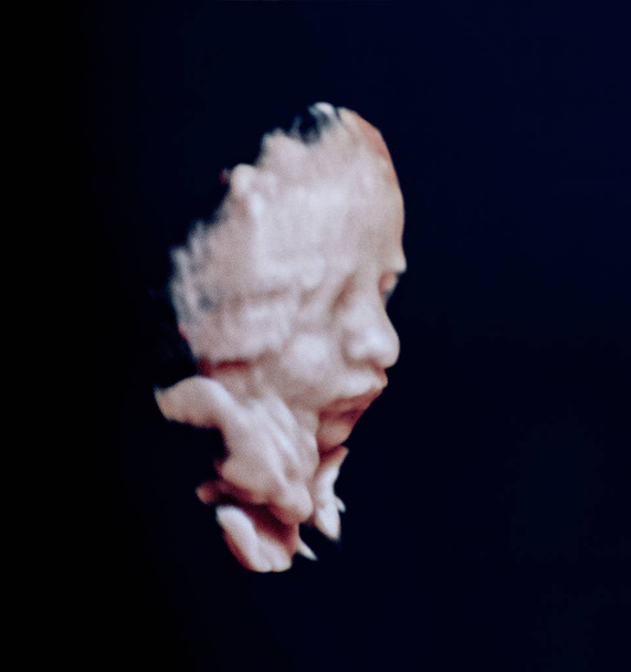Portrait échographique d'un fœtus dans l'utérus, avec pixellisation visible et bruit de couleur d'une impression numérique
.  - Photo, image