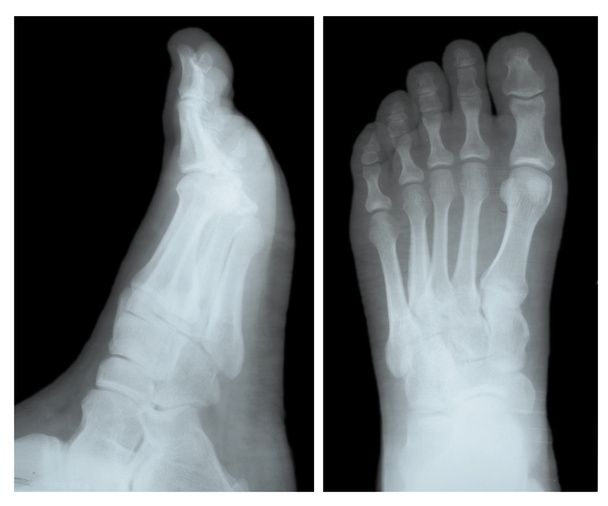 Radiographie des os des jambes en deux positions
 - Photo, image