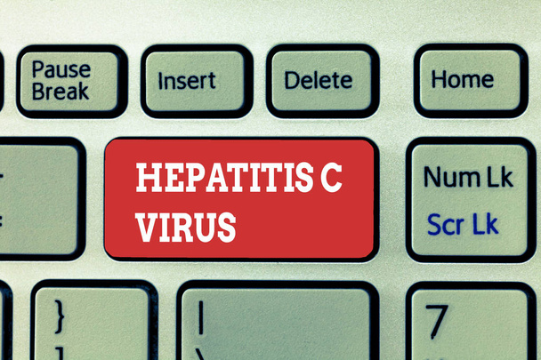 Rukopis textu psaní hepatitidy C Virus. Koncept význam infekční agent, který způsobuje onemocnění virová hepatitida - Fotografie, Obrázek