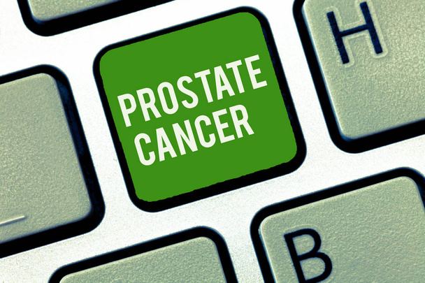 Konceptuální ručně psaného textu ukazuje rakovina prostaty. Obchodní fotografie představí rakoviny, který se vyskytuje v žlázy mužského reprodukčního systému - Fotografie, Obrázek