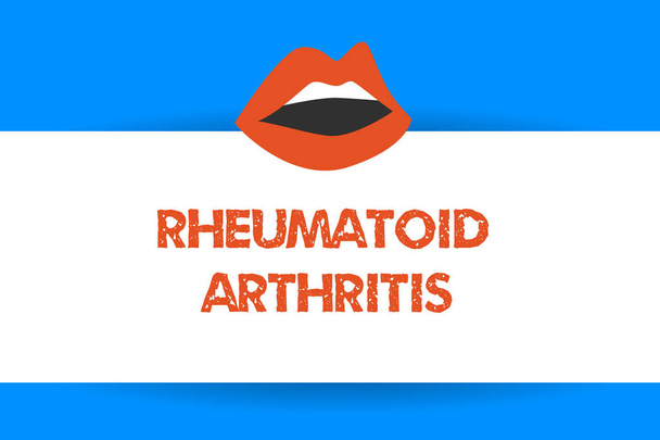 Írásbeli Megjegyzés mutatja a Rheumatoid Arthritis. Autoimmun betegség, ízületi fájdalom és a kárt okozó bemutató üzleti fotó - Fotó, kép