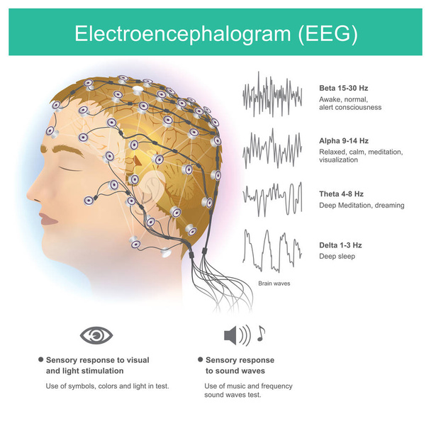 Použití elektrod číst malé elektromagnetické vlny z lidského mozku. - Vektor, obrázek