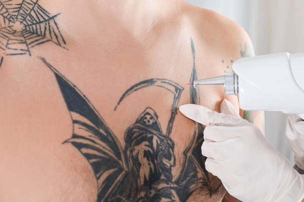 Man undergoing laser tattoo removal procedure in salon, closeup - Foto, Imagem
