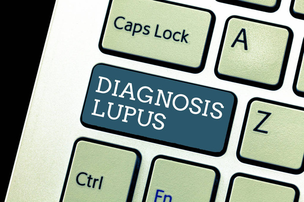 Writing note showing Diagnosis Lupus. Business photo showcasing Urine examination show an increase of protein level - Photo, Image