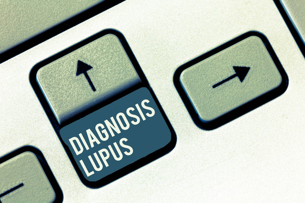 Schrijven van notitie weergegeven: diagnose Lupus. Zakelijke foto presentatie Urine onderzoek stijgen met eiwit niveau - Foto, afbeelding