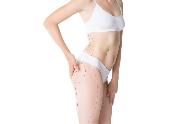 Liposuction, fat and cellulite removal concept, overweight female body with painted lines and arrows, isolated on white background - Foto, Imagen