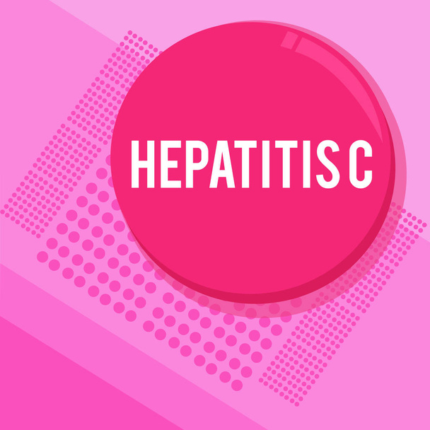 Slovo psaní textu hepatitidy C. obchodní koncept pro zánět jater v důsledku virové infekce onemocnění jater - Fotografie, Obrázek